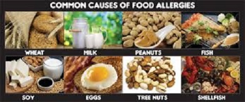 food allergies